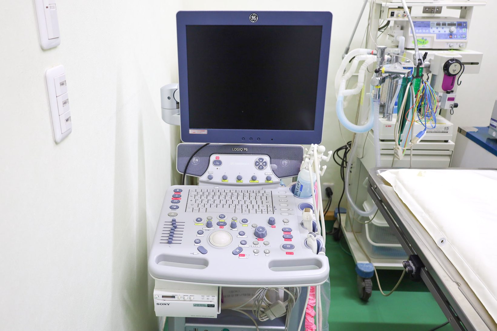 超音波検査機(エコー)